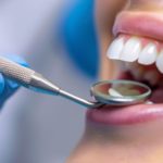 Revolucionando Sorrisos: A Evolução e os Benefícios dos Implantes Dentários